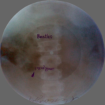 Double-sided flexible record made of X-ray pattern – двухсторонняя гибкая пластинка, сделанная из рентгеновского снимка