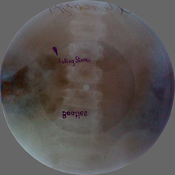 Double-sided flexible record made of X-ray pattern – двухсторонняя гибкая пластинка, сделанная из рентгеновского снимка